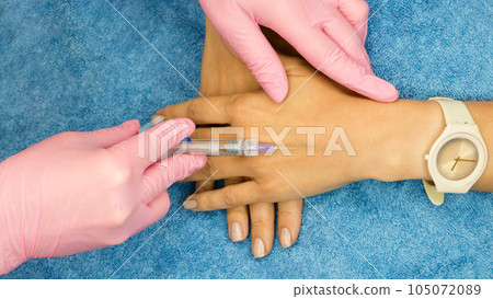 Biorevitalization hand skin rejuvenation for women Biorevitalization hand skin rejuvenation for women 105072089