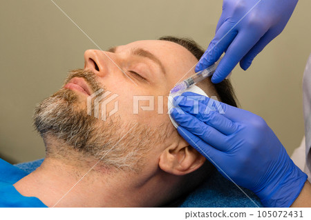 Mesotherapy rejuvenation injection for man Mesotherapy rejuvenation injection for man 105072431