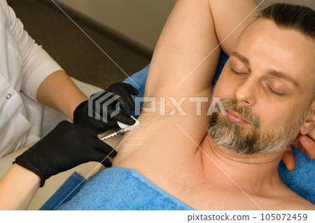 Treatment hyperhidrosis botulinum toxin Treatment hyperhidrosis botulinum toxin 105072459