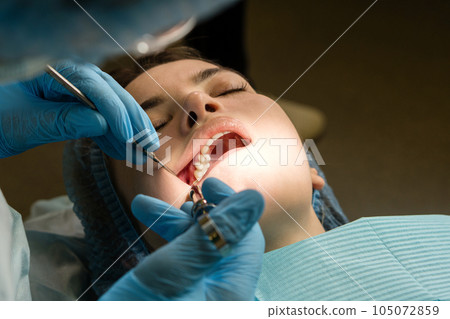 Anesthesia with lidocaine using carpool syringe Anesthesia with lidocaine using carpool syringe 105072859