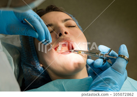 Anesthesia with lidocaine using carpool syringe Anesthesia with lidocaine using carpool syringe 105072862