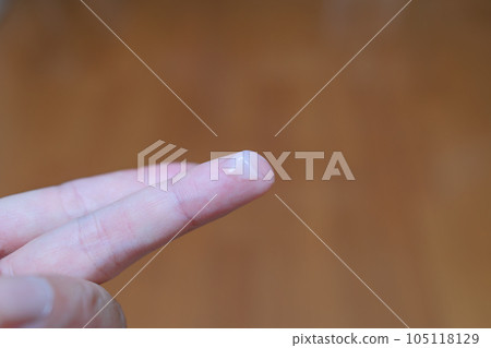 取適量藥膏塗於手指 105118129