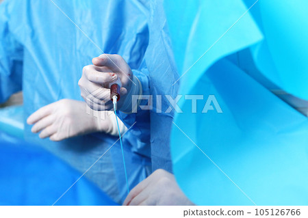 Surgery on blood vessels. Endovascular surgery. Removal of blood clots. Surgical interventions on blood vessels. The concept of healthcare. 105126766