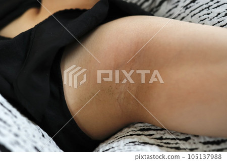 女性剃毛後幾天腋毛 105137988