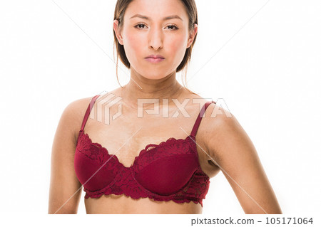 Latin honduras female with scleroderma autoimmune skin disease. Body positive unaltered skincare Latin honduras female with scleroderma autoimmune skin disease. Body positive unaltered skincare 105171064