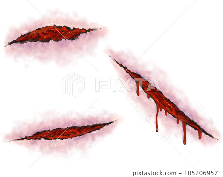 wound blood - Stock Illustration [105206957] - PIXTA