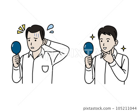 AGA, a young man who treats alopecia and grows hair 105211044