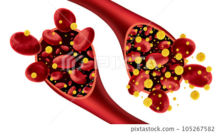 Diabetes And Diabetic 105267582