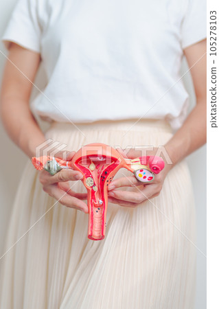 Woman holding Uterus and Ovaries model. Ovarian and Cervical cancer, Endometriosis, Hysterectomy, Uterine fibroids, Reproductive, menstruation, Stomach, Pregnancy and Sexual Transmitted disease Woman holding Uterus and Ovaries model. Ovarian and Cervical cancer, Endometriosis, Hysterectomy, Uterine fibroids, Reproductive, menstruation, Stomach, Pregnancy and Sexual Transmitted disease 105278103