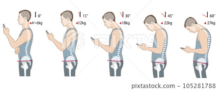 Skeletal diagram of neck tilt angle and load, hunchback and posterior pelvic tilt Skeletal diagram of neck tilt angle and load, hunchback and posterior pelvic tilt 105281788