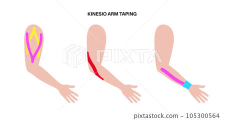 Kinesiology therapeutic tape Kinesiology therapeutic tape 105300564