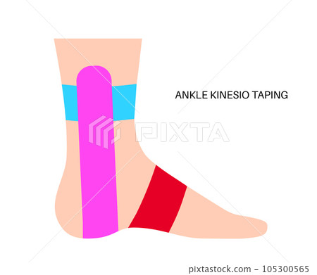 Kinesiology therapeutic tape Kinesiology therapeutic tape 105300565