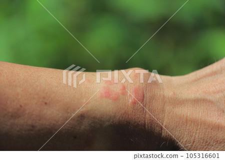 毛蟲咬痕 105316601