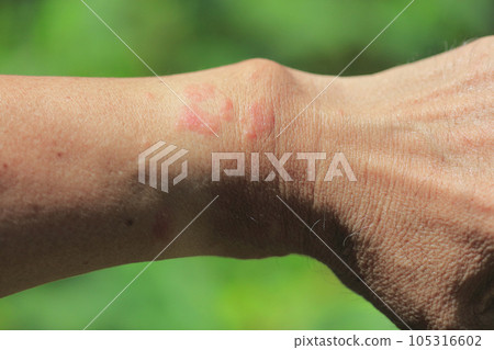 毛蟲咬痕 105316602