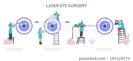 Eye laser surgery procedure infographic banner flat vector illustration. Eye laser surgery procedure infographic banner flat vector illustration. 105324573