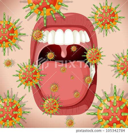 Herpes simplex virus (Lips/Mouth) - Stock Illustration [105342784] - PIXTA