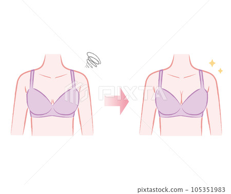 Breastfeeding Illustration of a body wearing a bra Before after 105351983