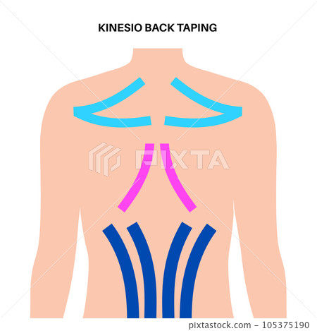 Kinesiology therapeutic tape 105375190