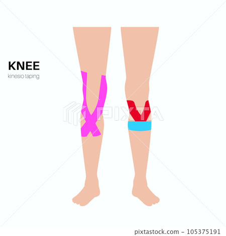 Kinesiology therapeutic tape Kinesiology therapeutic tape 105375191