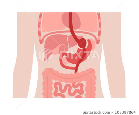 Gastric bypass surgery 105397864