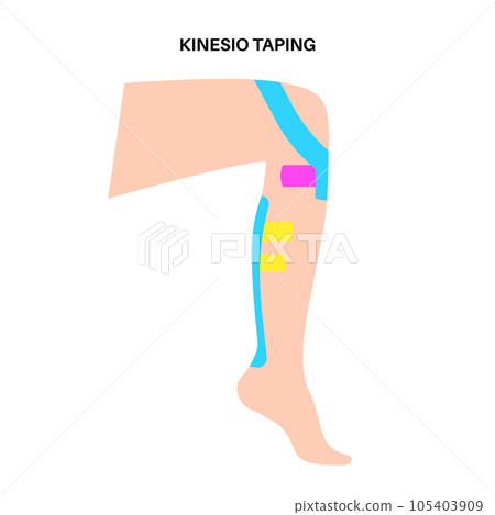 Kinesiology therapeutic tape Kinesiology therapeutic tape 105403909