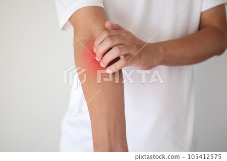 man itching and scratching on arm from itchy dry skin eczema dermatitis 105412575