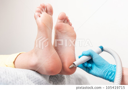 Pedicure master does a hardware peeling of the skin of the feet. Close-up of the heels. The concept of podology and chiropody Pedicure master does a hardware peeling of the skin of the feet. Close-up of the heels. The concept of podology and chiropody 105419715