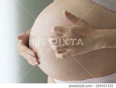 Hand scratching stomach with itchy stretch marks Hand scratching stomach with itchy stretch marks 105427135
