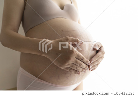 Pregnant woman putting her hand on her stomach with stretch marks and midline 105432155