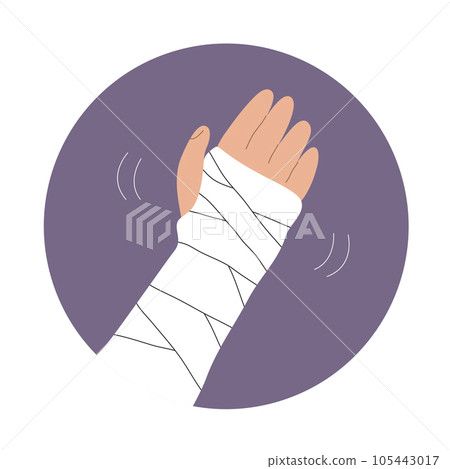 Illustration of plaster bondage on a broken arm 105443017