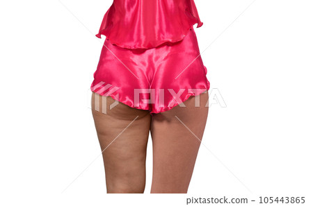 Woman's thighs and buttocks with cellulite. Woman's thighs and buttocks with cellulite. 105443865