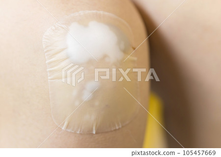A child who puts a moist pad on his knee wound Kizu Power Pad A child who puts a moist pad on his knee wound Kizu Power Pad 105457669
