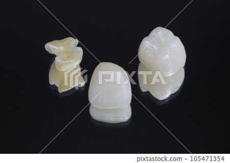 white and clean ceramic teeth 105471354