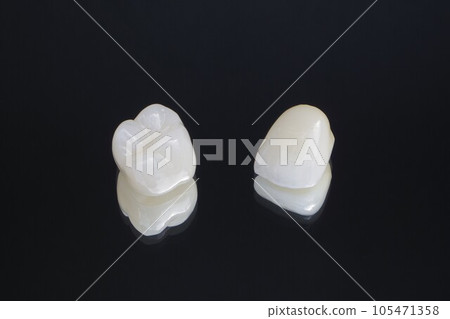 潔白潔淨的烤瓷牙 105471358