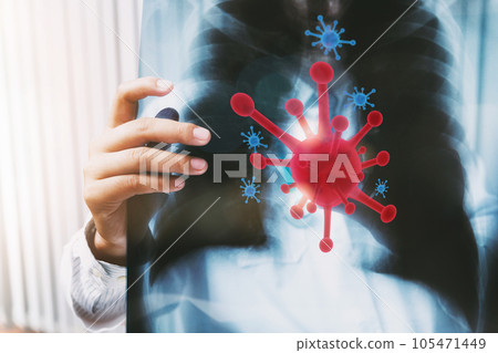A doctor is diagnosing the results of the lung X-rays of patients infected with the coronavirus. 105471449