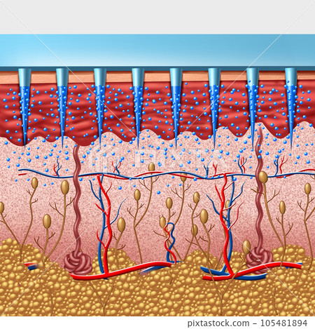 Microneedle Medical device 105481894