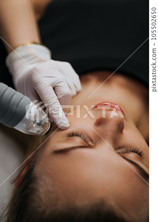 Microneedle RF lifting procedure. Hardware cosmetology. 105502650