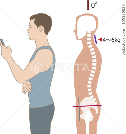 Angle of neck looking at smartphone and load, tilt 0 degrees Angle of neck looking at smartphone and load, tilt 0 degrees 105520029