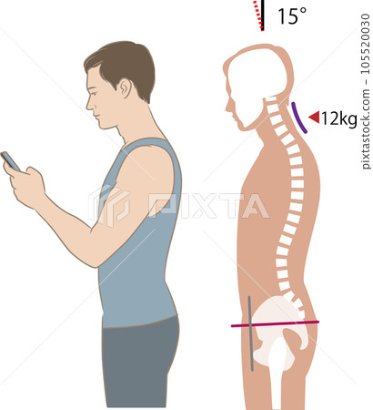 Angle of neck looking at smartphone and load, tilt 15 degrees Angle of neck looking at smartphone and load, tilt 15 degrees 105520030