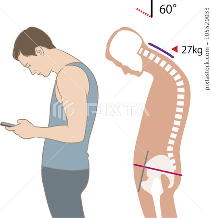 Angle of neck looking at smartphone and load, tilt 60 degrees 105520033