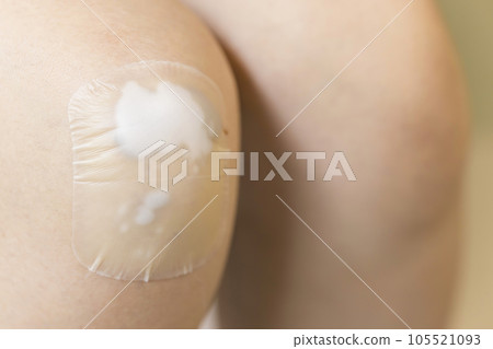 A child who puts a moist pad on his knee wound Kizu Power Pad A child who puts a moist pad on his knee wound Kizu Power Pad 105521093