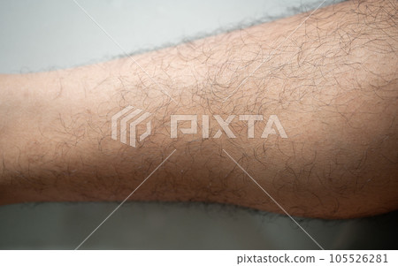 Cropped shot view of men's leg with messy shin hair grows. Leg hair is the hair that grows on the human legs and usually appears after the onset of puberty. Cropped shot view of men's leg with messy shin hair grows. Leg hair is the hair that grows on the human legs and usually appears after the onset of puberty. 105526281