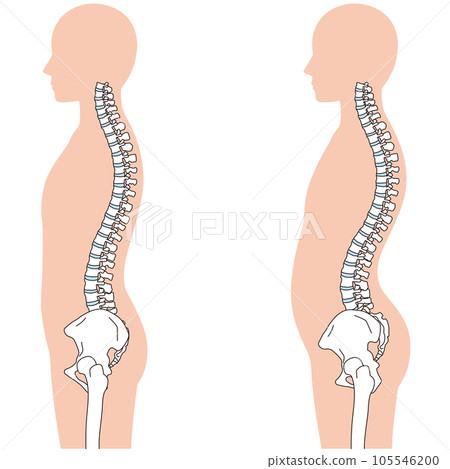 腰部曲度姿勢對比 腰部曲度姿勢對比 105546200