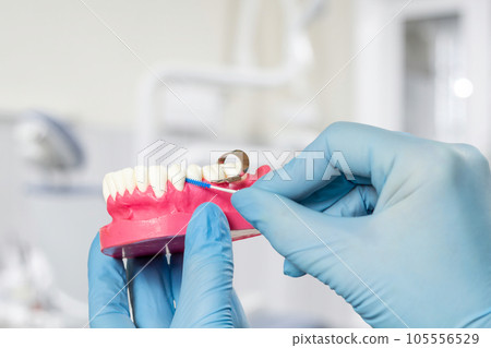 Dentist with an interdental toothpick brush and a layout of the human jaw. Dentist with an interdental toothpick brush and a layout of the human jaw. 105556529