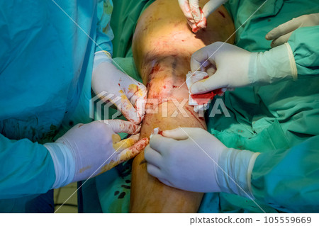 Orthopedic surgeons perform surgeries on leg to treat patient sustained a injuries. Orthopedic surgeons perform surgeries on leg to treat patient sustained a injuries. 105559669