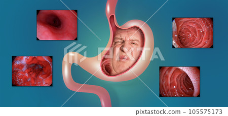 Stomach pain. Male suffering face isolated on blue background 105575173