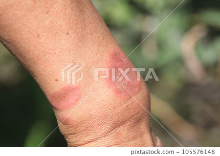 Caterpillar bite marks = after that 105576148
