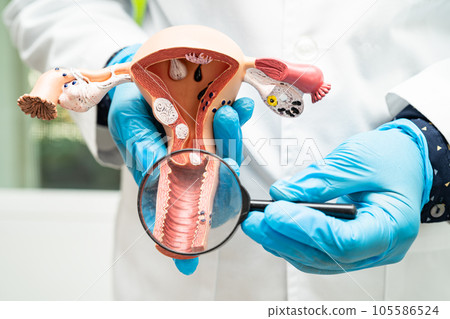 Uterus, doctor holding anatomy model for study diagnosis and treatment in hospital. Uterus, doctor holding anatomy model for study diagnosis and treatment in hospital. 105586524
