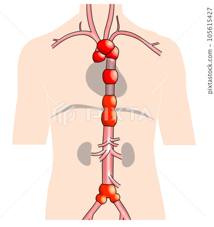 Simple aorta schematic from neck to waist 105615427