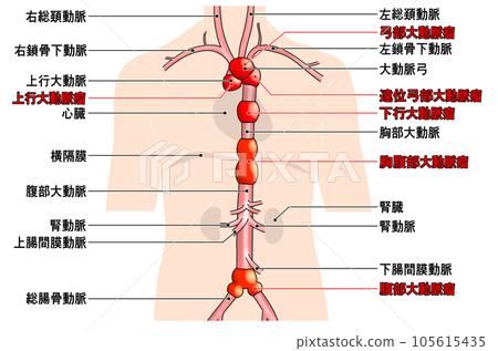 Simple aorta schematic from neck to waist 105615435